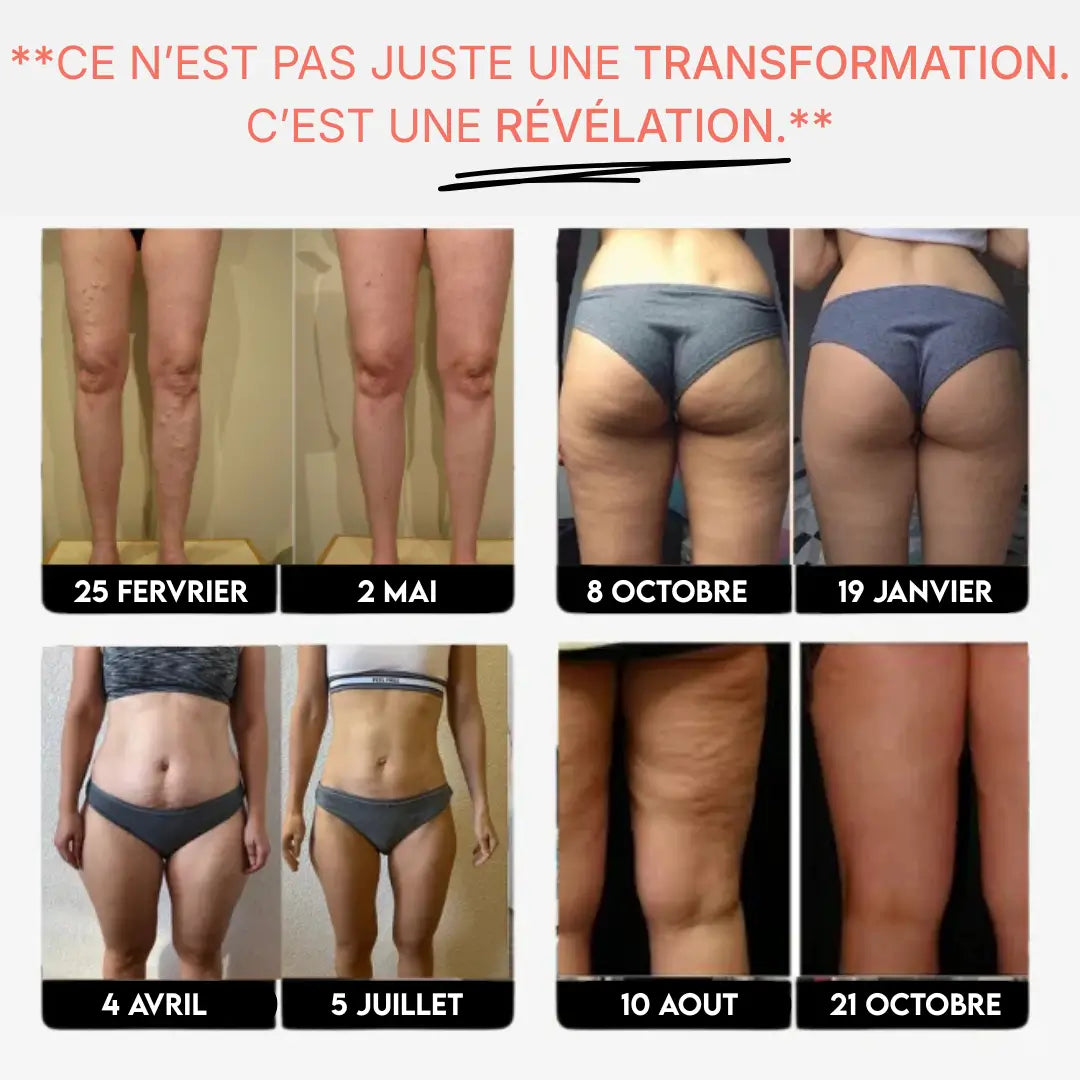 Anti-Cellulite 3D Leggings – Reshape your figure effortlessly