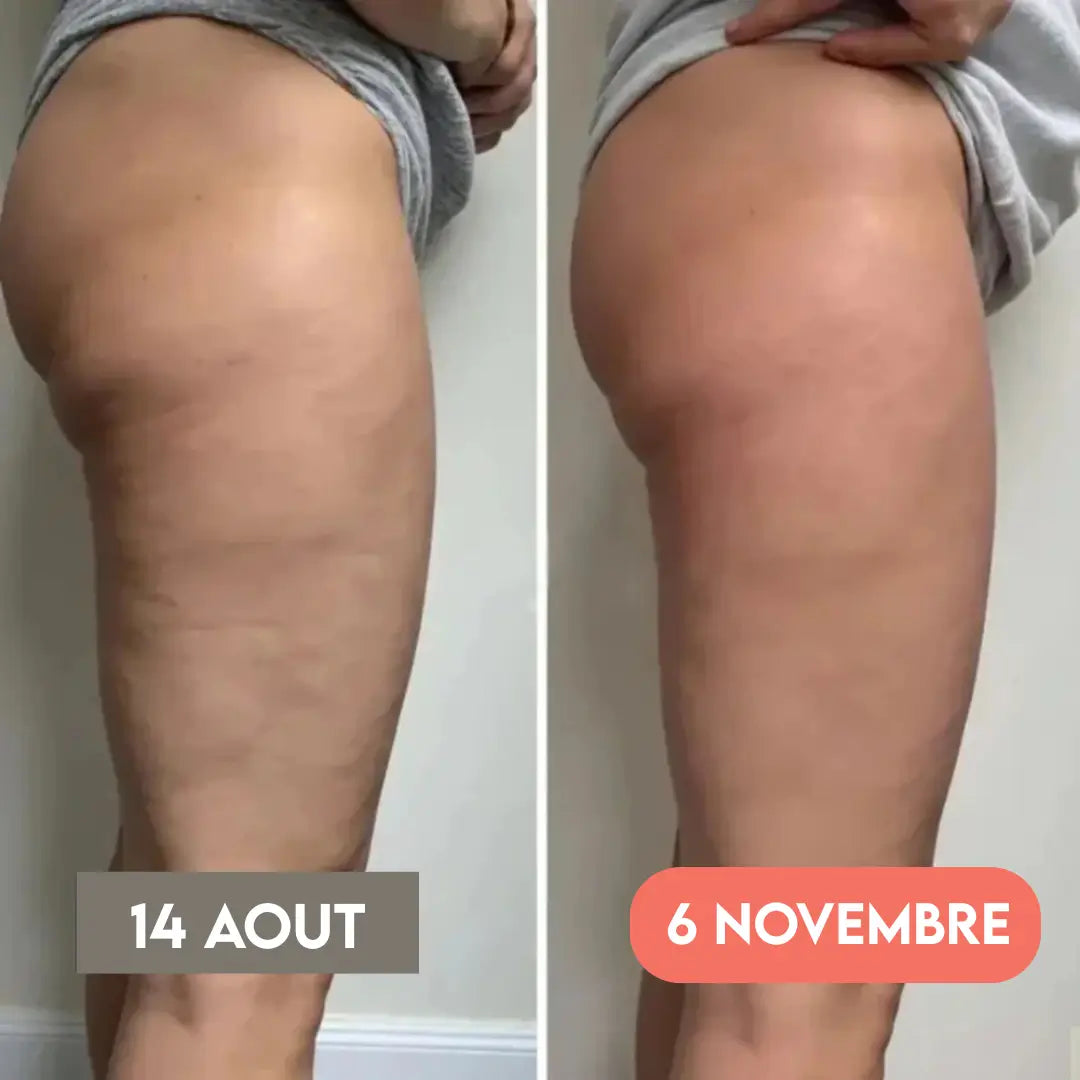 Anti-Cellulite 3D Leggings – Reshape your figure effortlessly