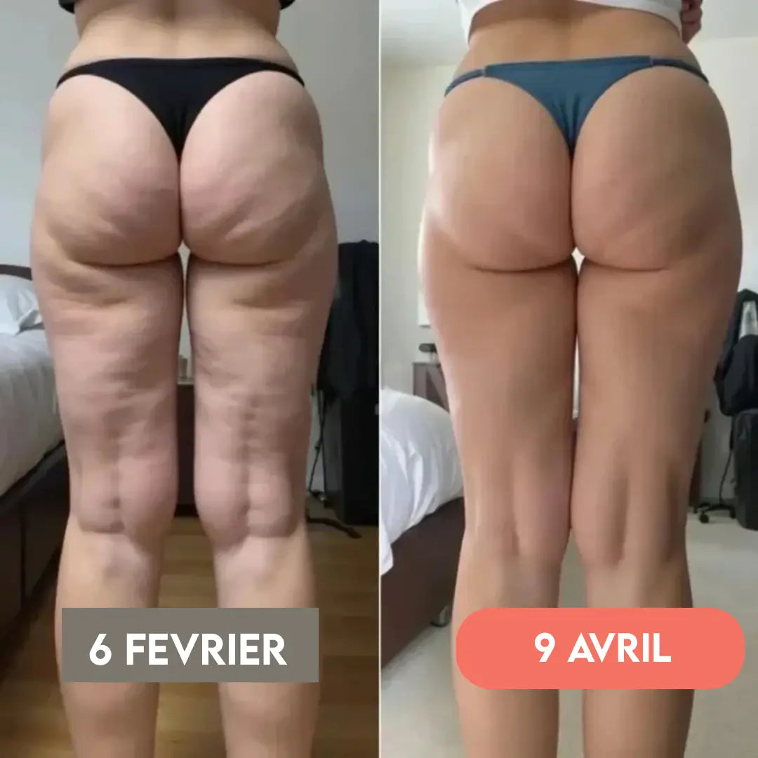 Anti-Cellulite 3D Leggings – Reshape your figure effortlessly
