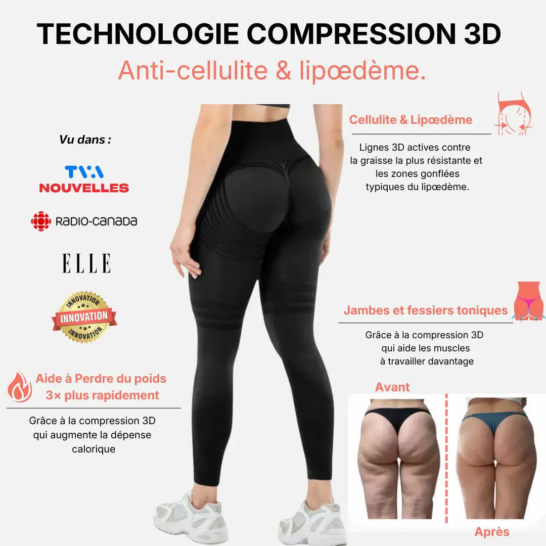 Anti-Cellulite 3D Leggings – Reshape your figure effortlessly